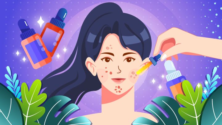 Illustration of a girl applying CBD Oil for her Acne.