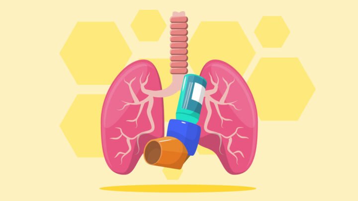 Illustration of an Asthmatic Lungs with Nebulizer on the center