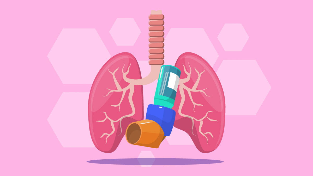 Illustration of an Asthmatic Lungs with Nebulizer on the center