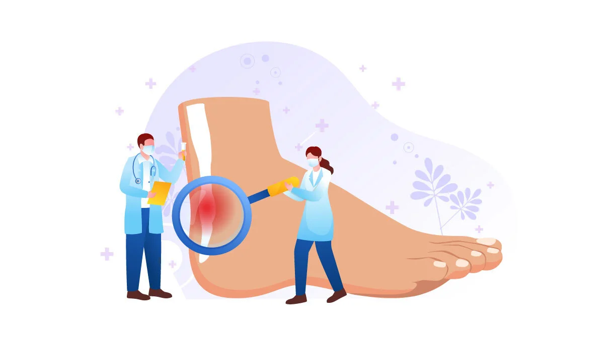 Illustration of Two Doctors Checking Tendonitis on the Patient's Foot