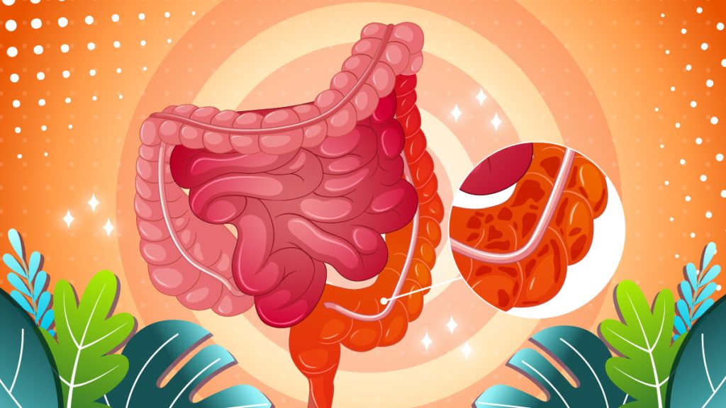 CBD Oil for Ulcerative Colitis Can Cannabis Oil Help & Dosage? CFAH