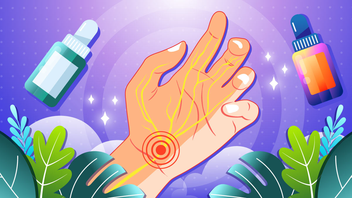 Illustration of a Carpal Tunnel Syndrome