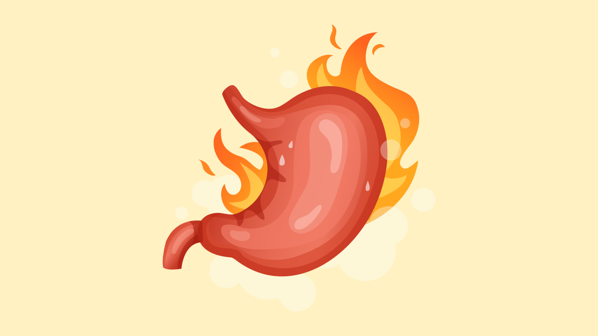 Illustration of Acid Reflux and GERD on Yellow background