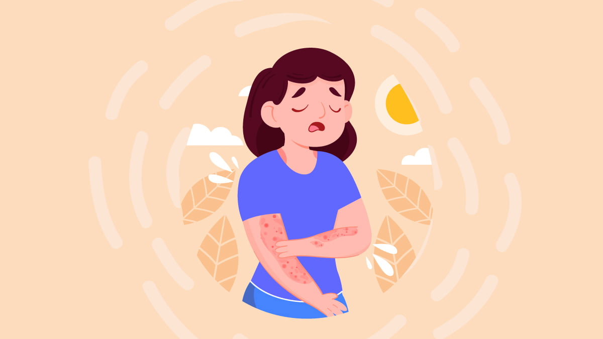 Illustration of a Woman With Psoriasis on Her Skin