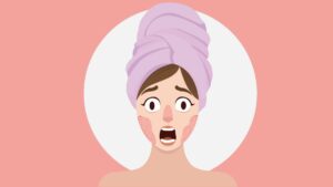 Illustration of Woman Shock with Redness on Face with Towel on Head