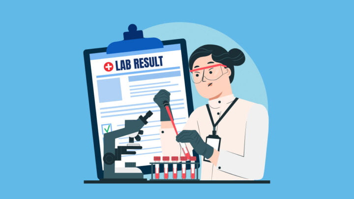 Illustration of a scientist testing CBD oil and a lab result