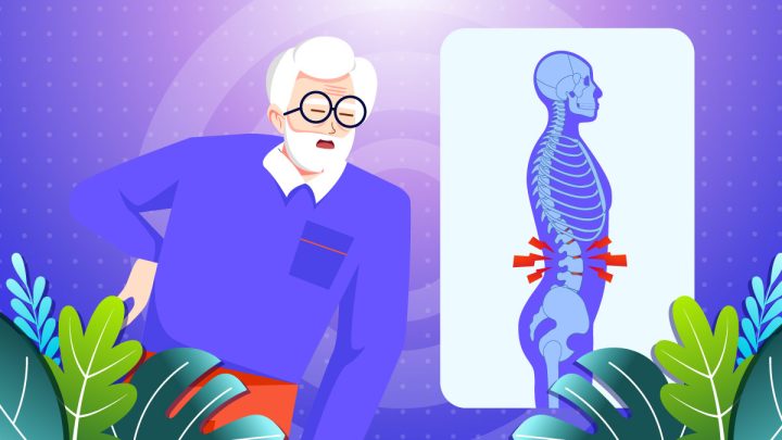 Illustration of an old man suffering from spinal stenosis.