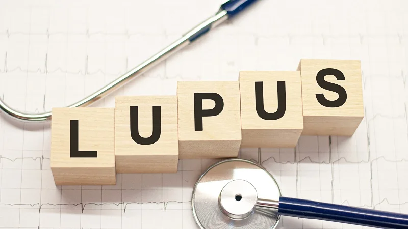 word Lupus on wooden blocks and a stethoscope with EKG test results as background