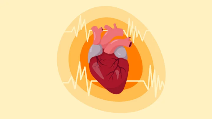 Illustration of Heart with AFib