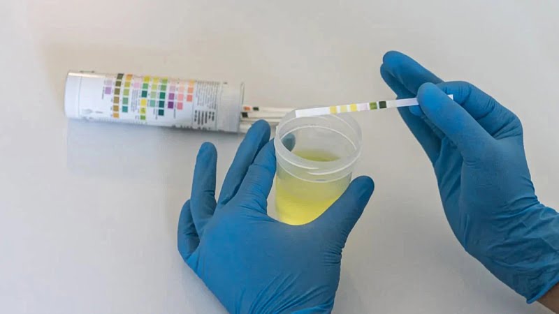 hand with blue gloves checcking the results of a drug test