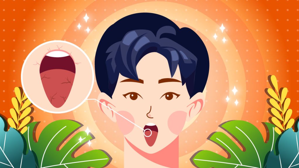 CBD and Dry Mouth Causes, Symptoms & How to Avoid It