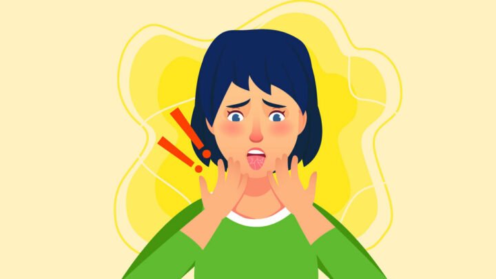 Illustration for CBD and Dry Mouth