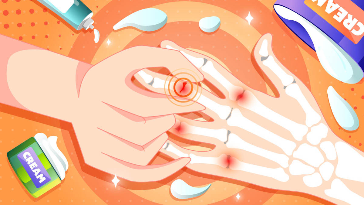 Arthritis on a finger and CBD cream illustration