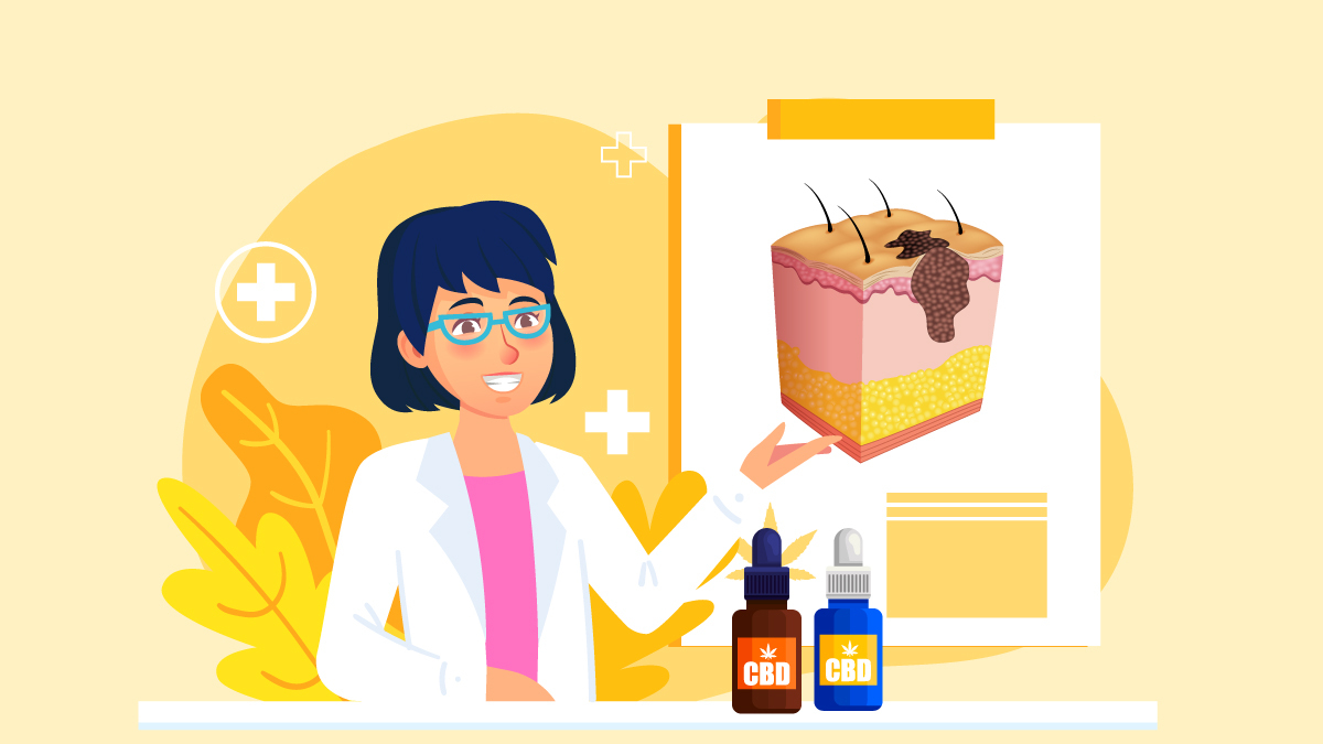 Illustration of CBD oil for Skin Cancer