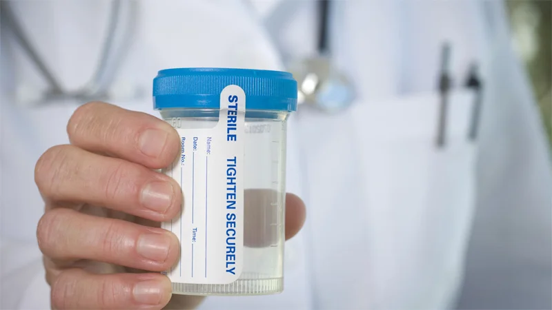 A doctor with a drug testing cup