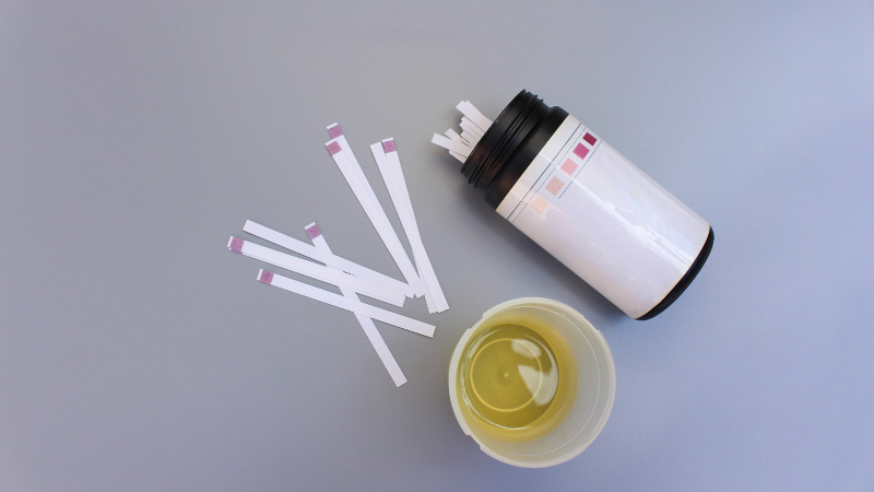 Urine test strips and urine sample on gray background