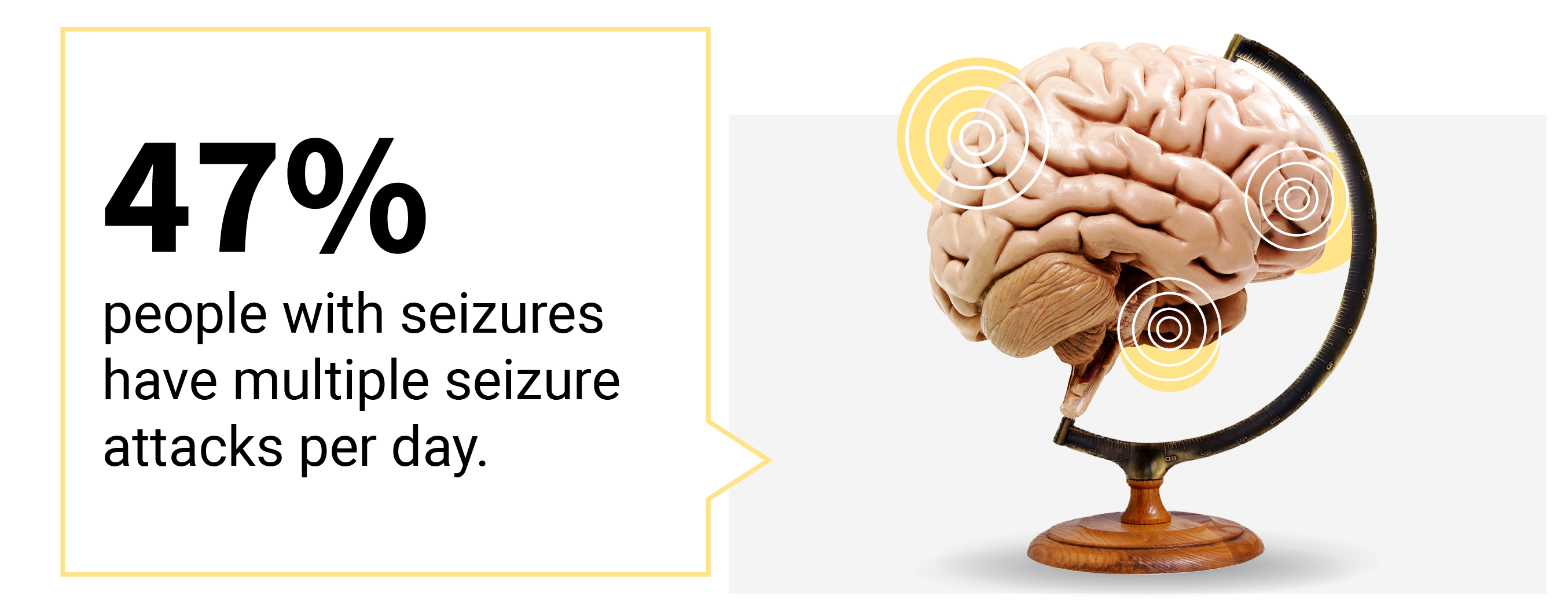 Call out text box saying 47% of people with seizures have multiple attacks per day.