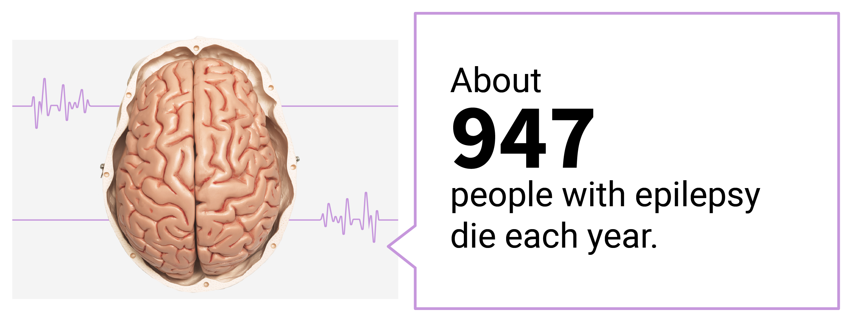 Call out text box saying 974 people with epilepsy die yearly.
