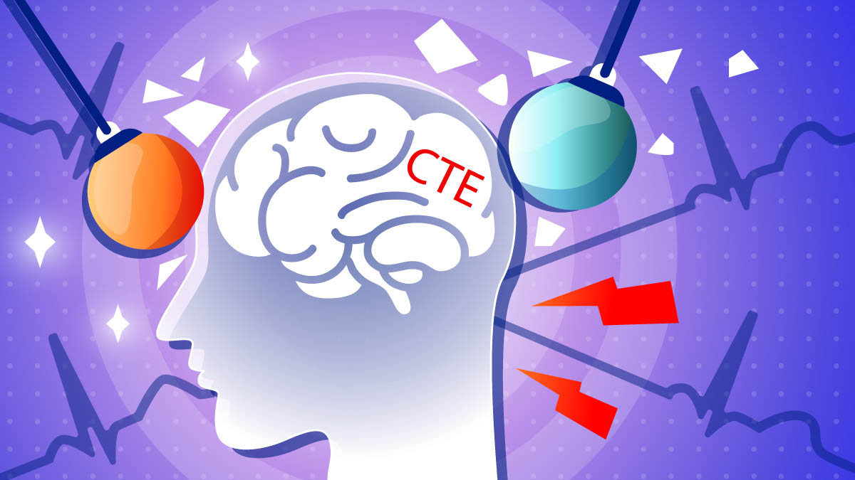 Illustration of CBD for CTE